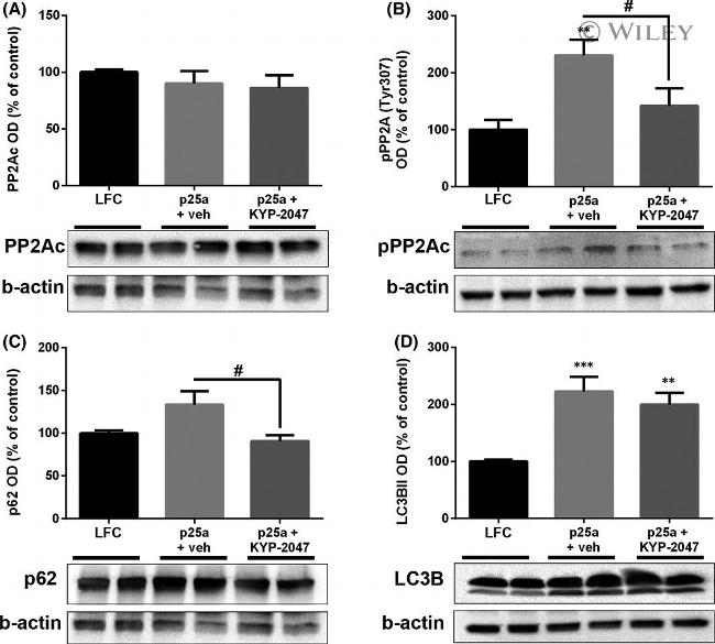 Phospho-PP2A alpha (Tyr307) Antibody in Western Blot (WB)