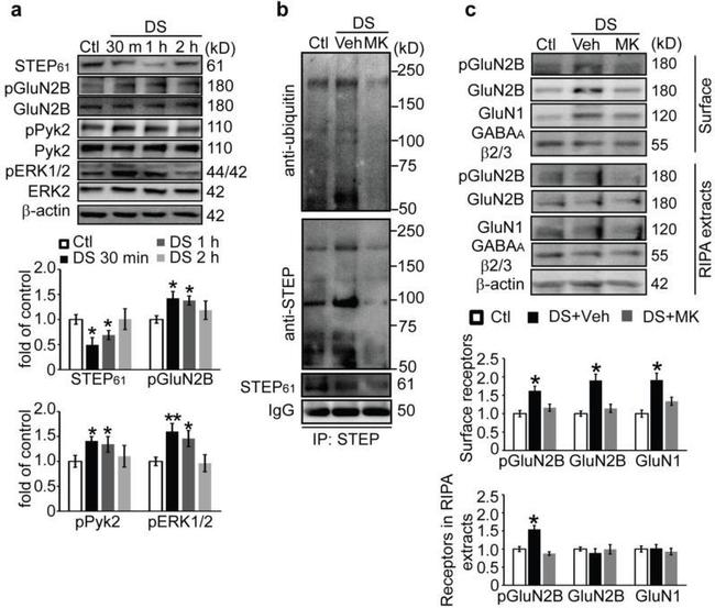 Ubiquitin Antibody in Western Blot (WB)