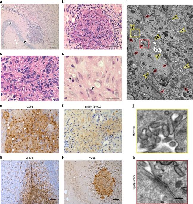 Cytokeratin 18 Antibody in Immunohistochemistry (IHC)