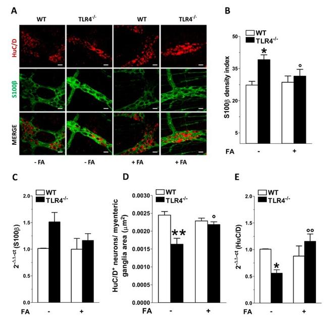 HuC/HuD Antibody in Immunohistochemistry (IHC)