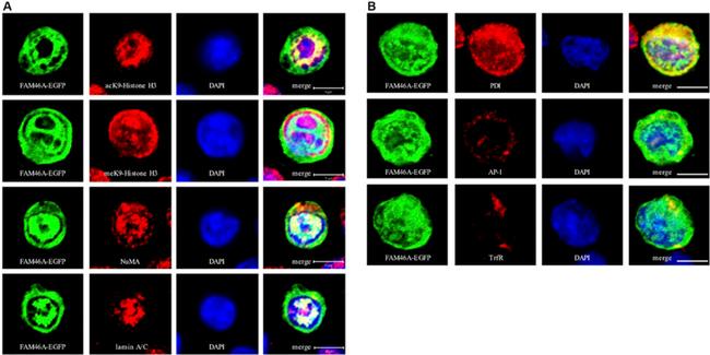 PDI Antibody in Immunocytochemistry (ICC/IF)