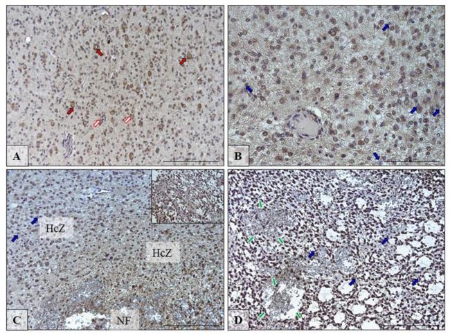 SCD Antibody in Immunohistochemistry, Immunohistochemistry (PFA fixed) (IHC, IHC (PFA))