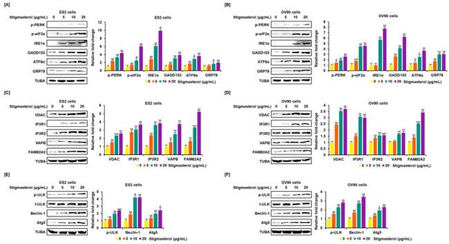 VAPB Antibody in Western Blot (WB)