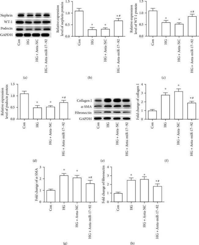 Alpha-Smooth Muscle Actin Antibody in Western Blot (WB)