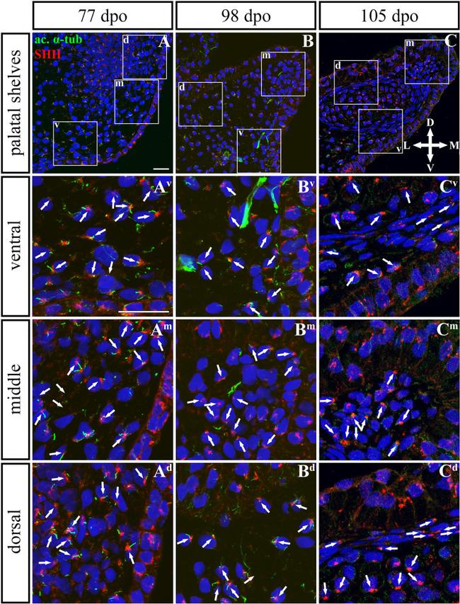 Acetyl-alpha Tubulin (Lys40) Antibody in Immunohistochemistry (IHC)