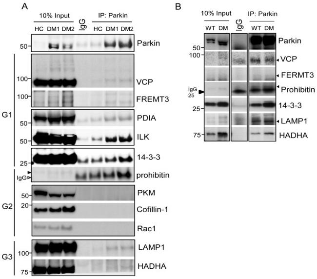 VCP Antibody in Western Blot (WB)