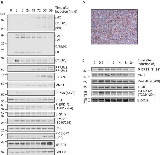 Phospho-eIF4E (Ser209) Antibody in Western Blot (WB)