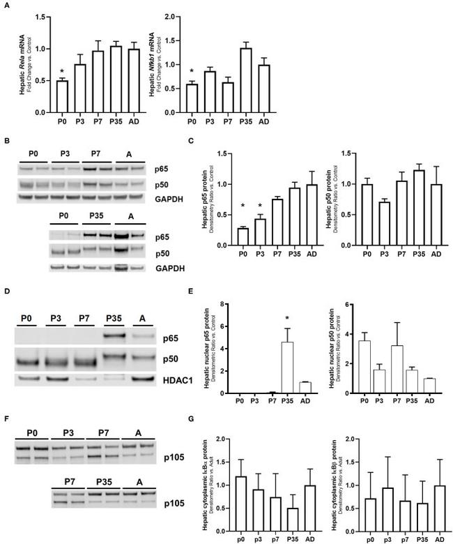 IkB beta Antibody in Western Blot (WB)