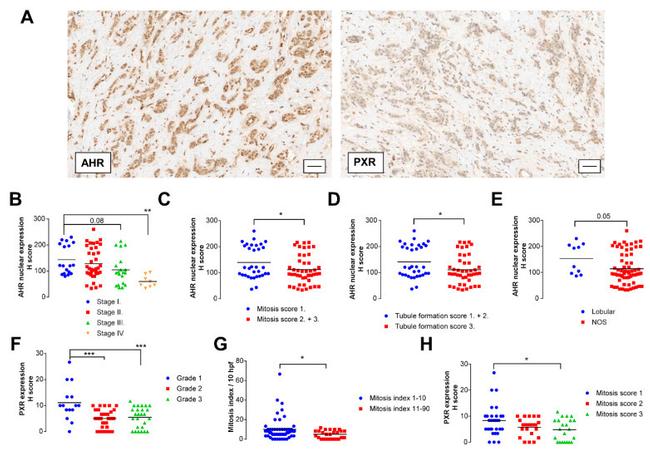 PXR Antibody in Immunohistochemistry (IHC)