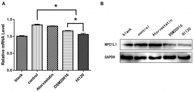 NPC1L1 Antibody in Western Blot (WB)