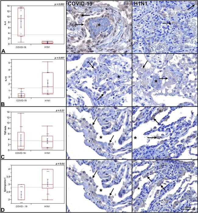 IL-4 Antibody in Immunohistochemistry (IHC)