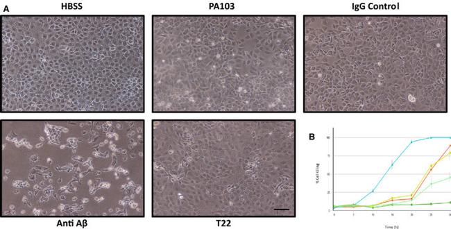 beta Amyloid Antibody in Neutralization (Neu)