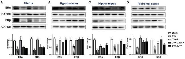 Estrogen Receptor alpha Antibody in Western Blot (WB)