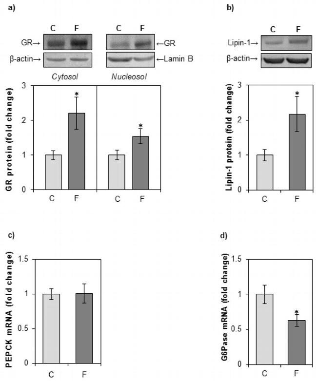 Glucocorticoid Receptor Antibody in Western Blot (WB)