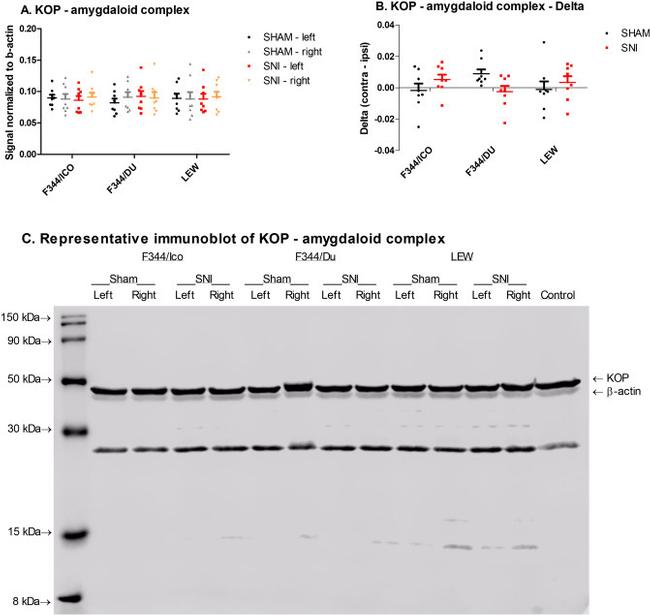 OPRK1 Antibody in Western Blot (WB)