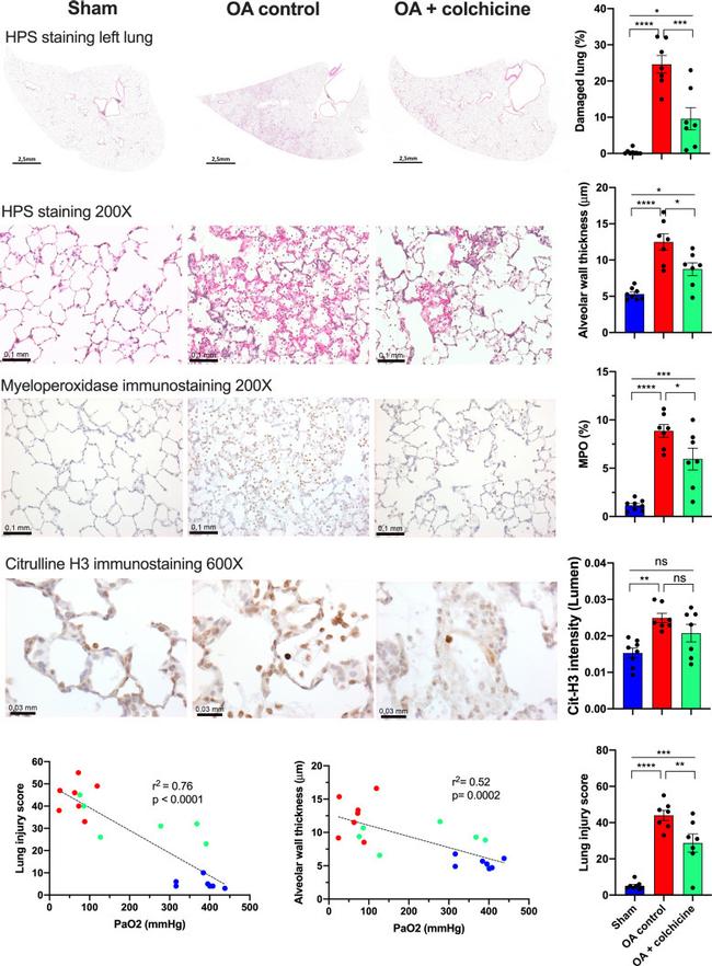 Myeloperoxidase Antibody in Immunohistochemistry (IHC)