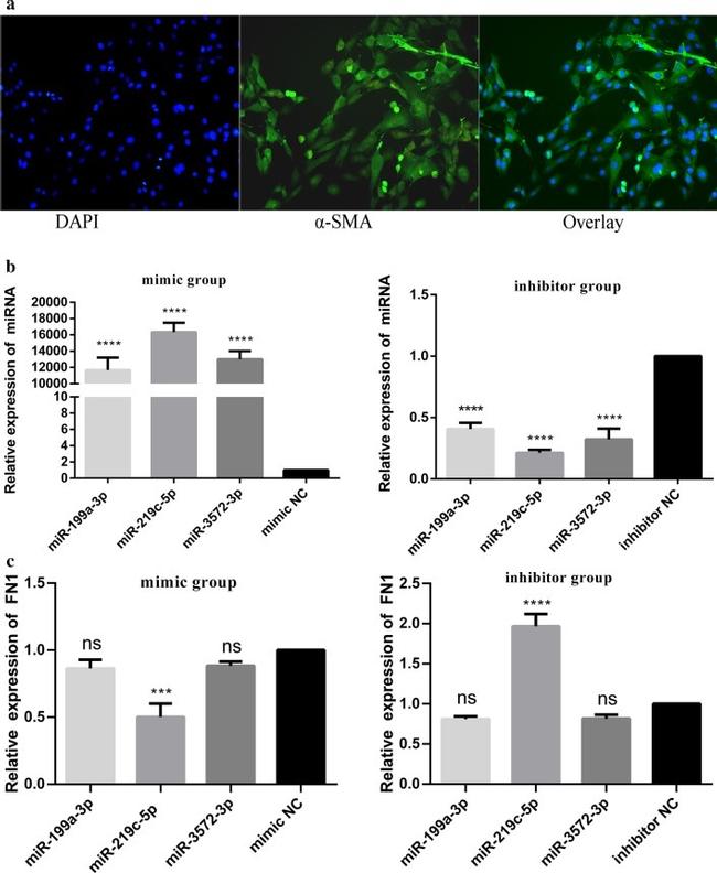 Alpha-Smooth Muscle Actin Antibody in Immunocytochemistry (ICC/IF)