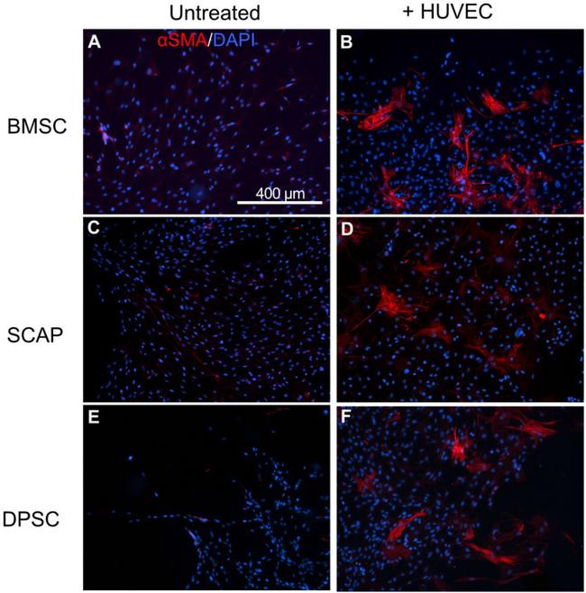 Alpha-Smooth Muscle Actin Antibody in Immunocytochemistry (ICC/IF)