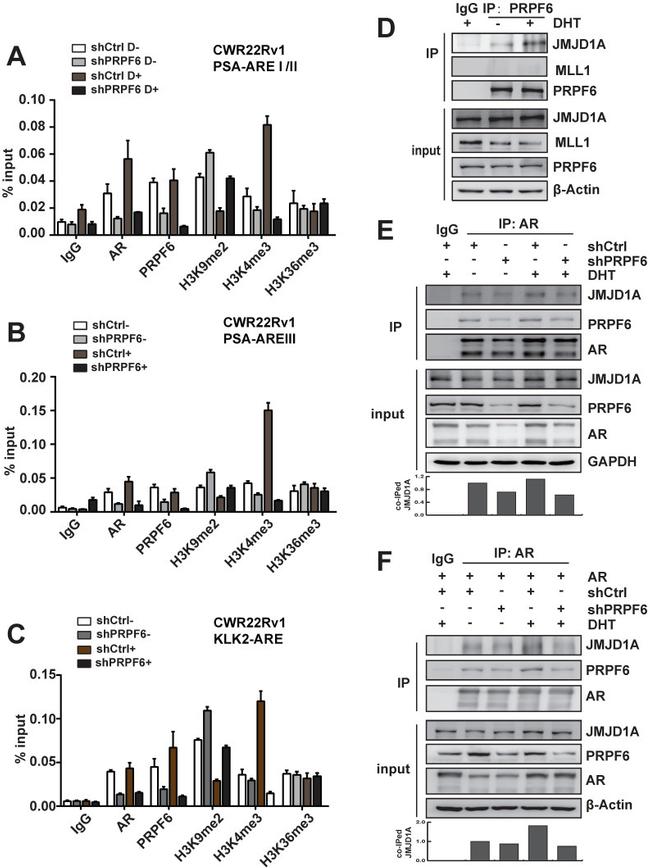 Androgen Receptor Antibody in Western Blot (WB)