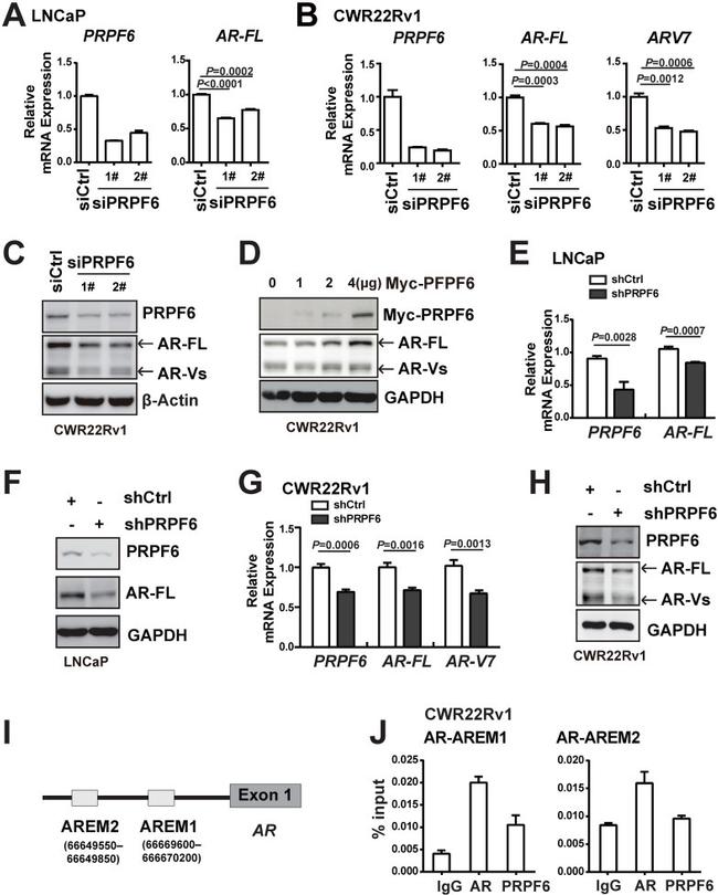 Androgen Receptor Antibody in Western Blot (WB)