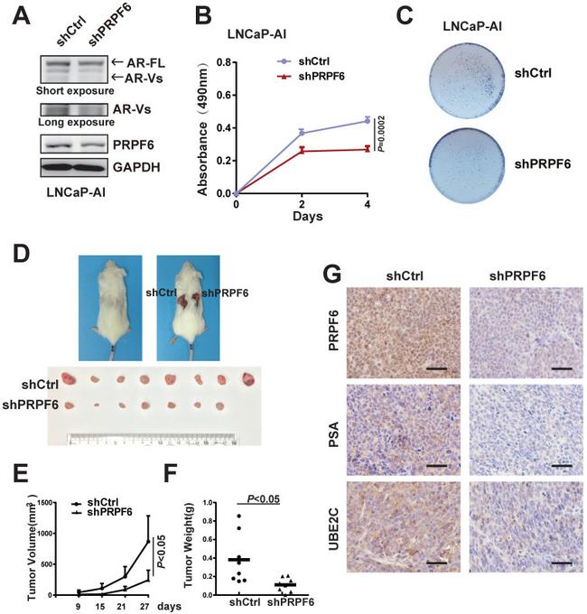 Androgen Receptor Antibody in Western Blot (WB)