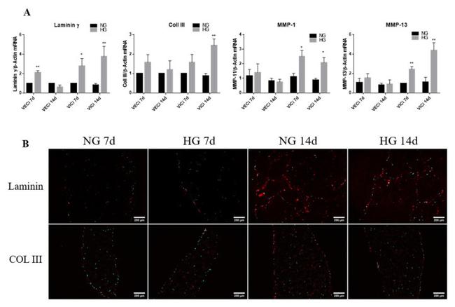 Collagen III Antibody in Immunocytochemistry, Immunohistochemistry (Frozen) (ICC/IF, IHC (F))