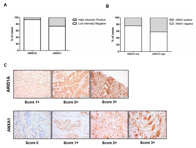 Annexin A1 Antibody in Immunohistochemistry (IHC)