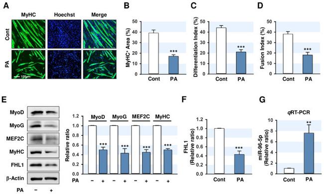 MEF2C Antibody in Western Blot (WB)