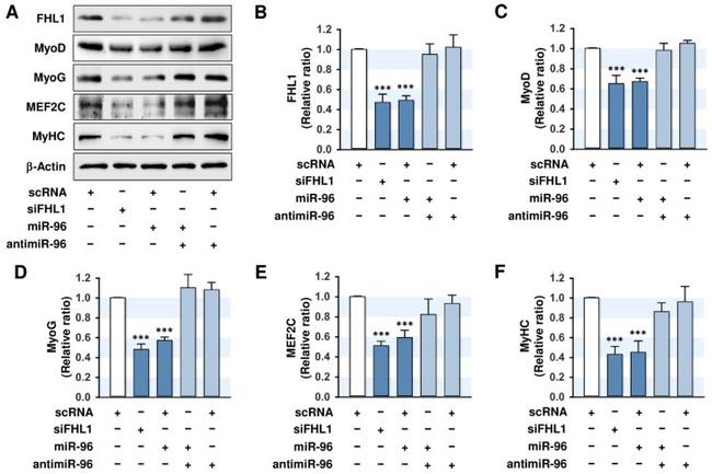 MEF2C Antibody in Western Blot (WB)