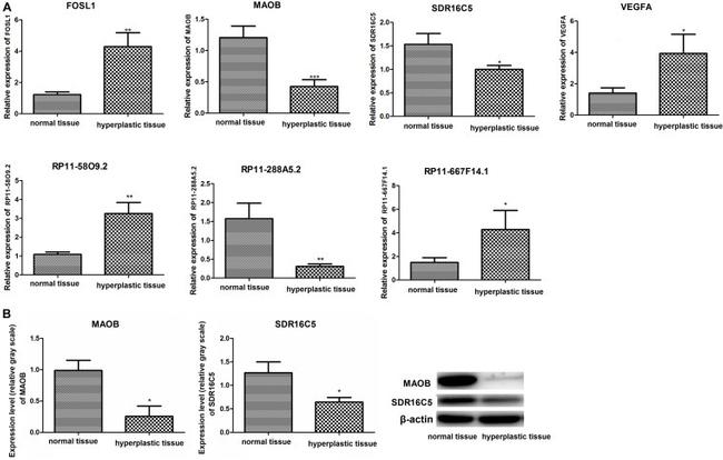 SDR16C5 Antibody in Western Blot (WB)