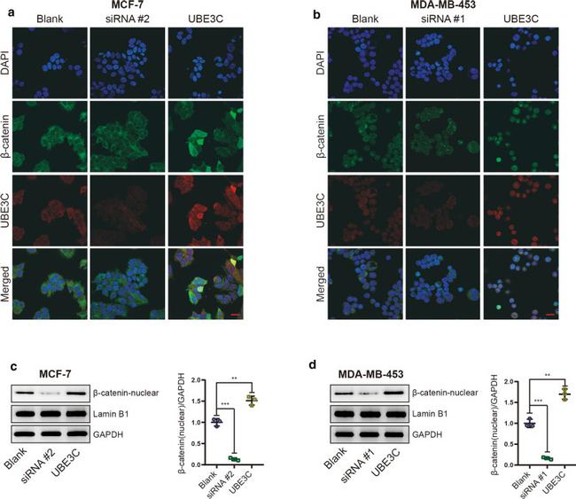 Synapsin 1 Antibody in Immunocytochemistry (ICC/IF)