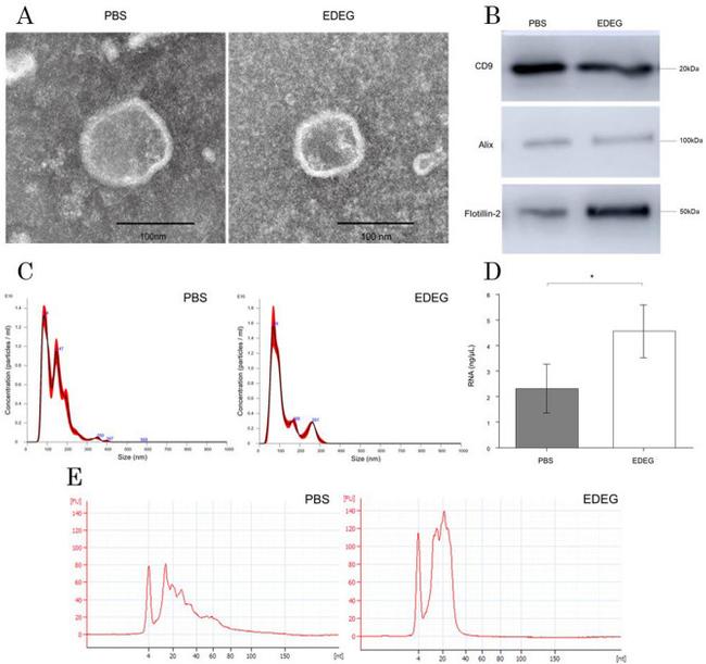 NACA Antibody in Western Blot (WB)