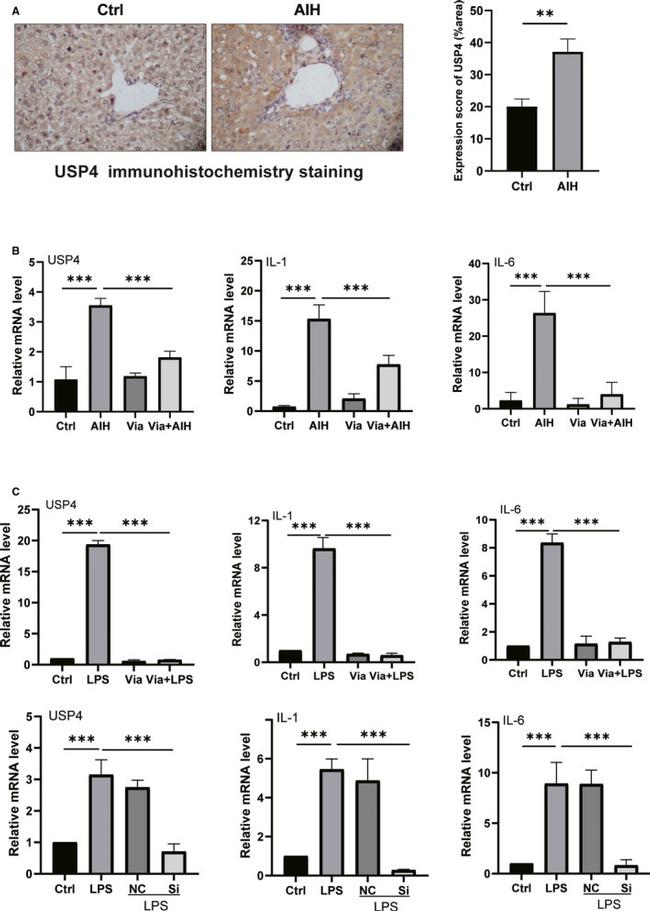 USP4 Antibody in Immunohistochemistry, Immunohistochemistry (Paraffin) (IHC, IHC (P))