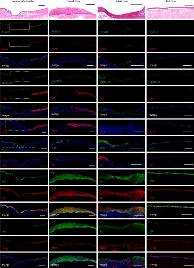 Cytokeratin 10 Antibody in Immunocytochemistry (ICC/IF)