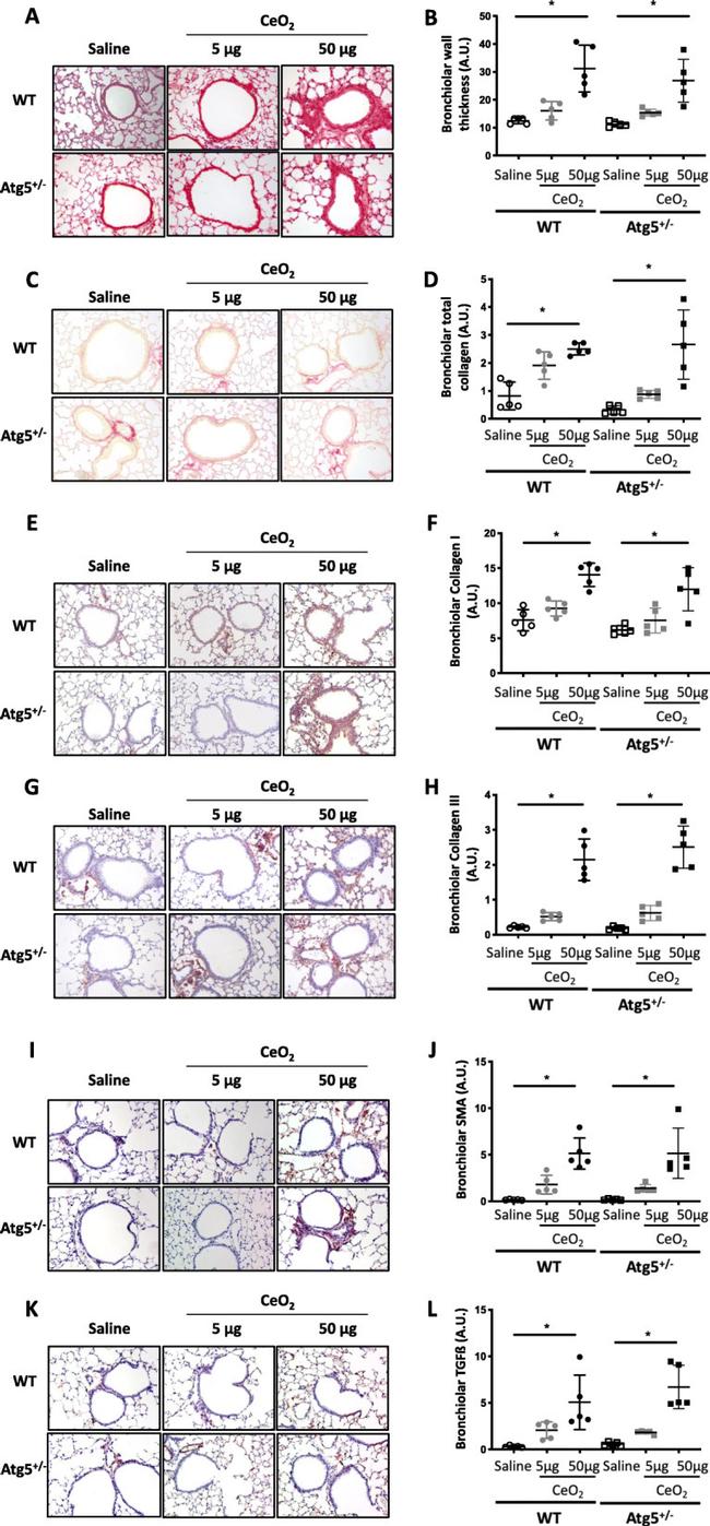 TGF beta-2 Antibody in Immunohistochemistry (IHC)