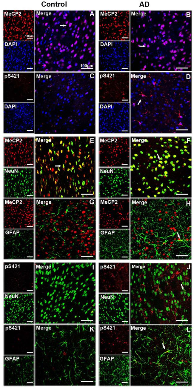 Phospho-MECP2 (Ser421) Antibody in Immunocytochemistry (ICC/IF)