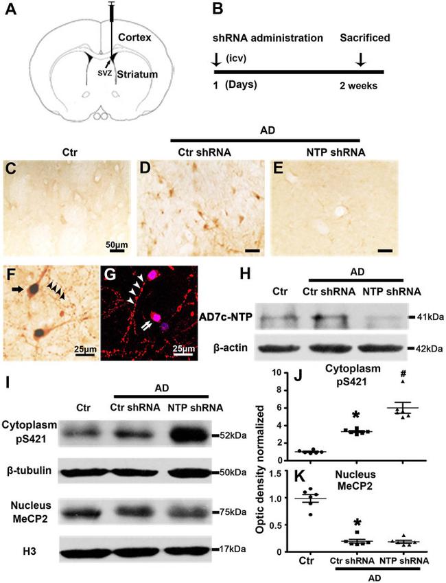 Phospho-MECP2 (Ser421) Antibody in Western Blot (WB)