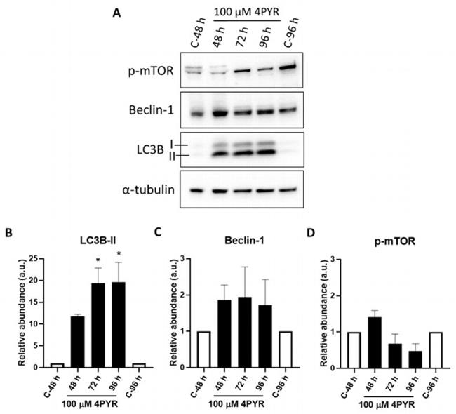 LC3B Antibody in Western Blot (WB)