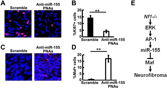 c-MAF Antibody in Immunocytochemistry, Immunohistochemistry (Paraffin) (ICC/IF, IHC (P))