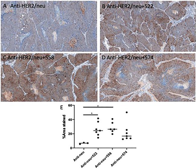 CD8 alpha Antibody in Immunohistochemistry (IHC)