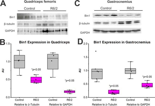 beta Tubulin Antibody in Western Blot (WB)