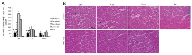 CD4 Antibody in Immunohistochemistry (IHC)