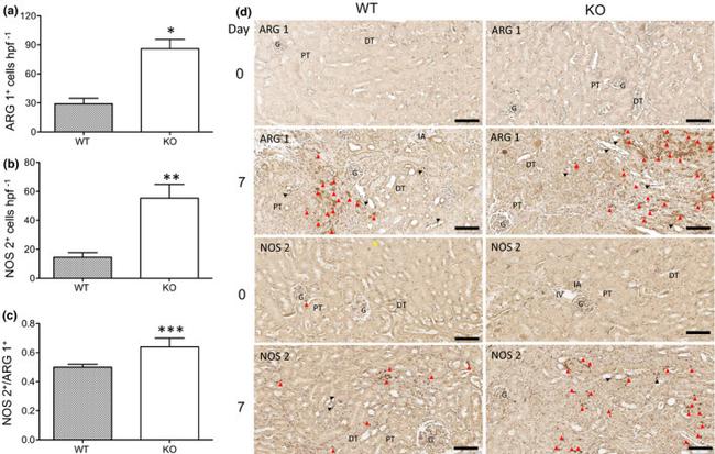 Arginase 1 Antibody in Immunohistochemistry (IHC)