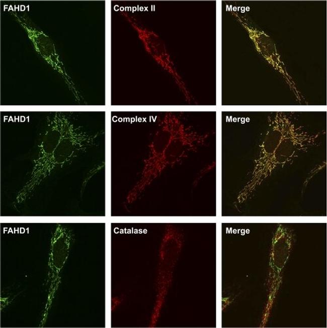 SDHA Antibody in Immunohistochemistry (IHC)