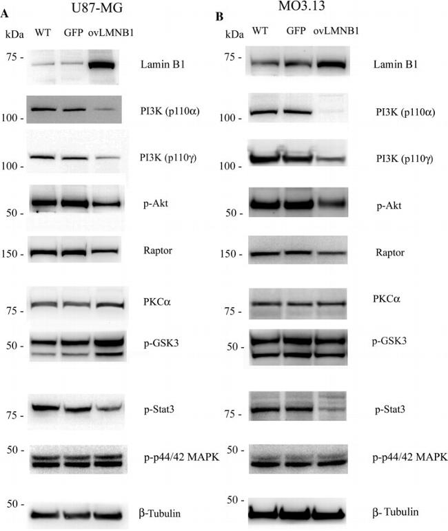 PKC alpha Antibody in Western Blot (WB)