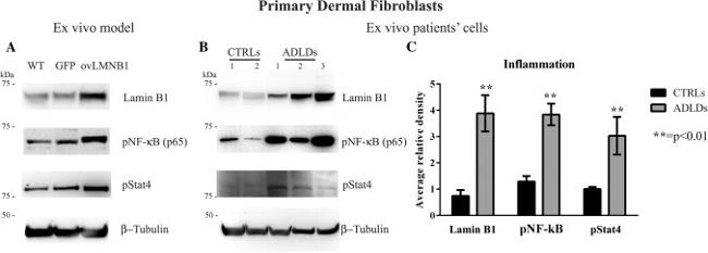 Phospho-STAT4 (Tyr693) Antibody in Western Blot (WB)