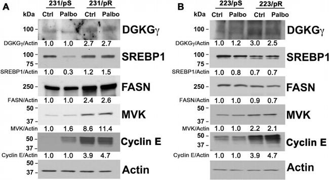 DGKG Antibody in Western Blot (WB)