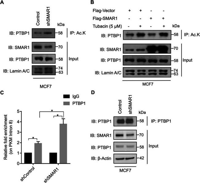 PTBP1 Antibody in Western Blot, Immunoprecipitation (WB, IP)