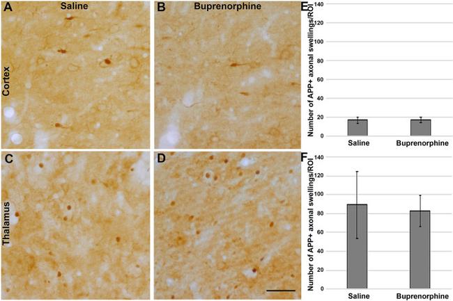 beta Amyloid Antibody in Immunohistochemistry (IHC)