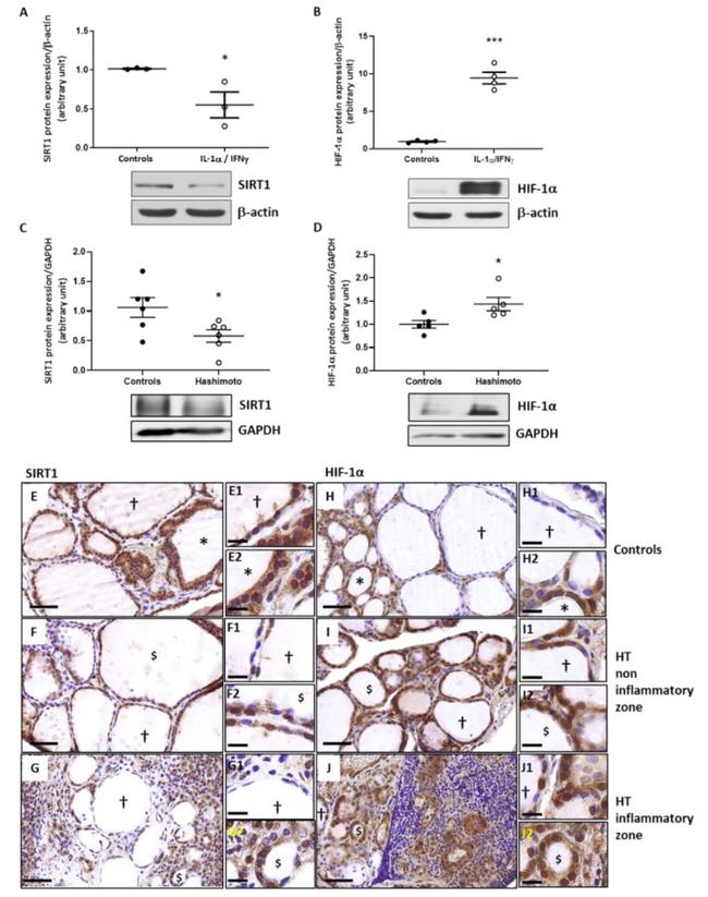 SIRT1 Antibody in Immunohistochemistry (IHC)